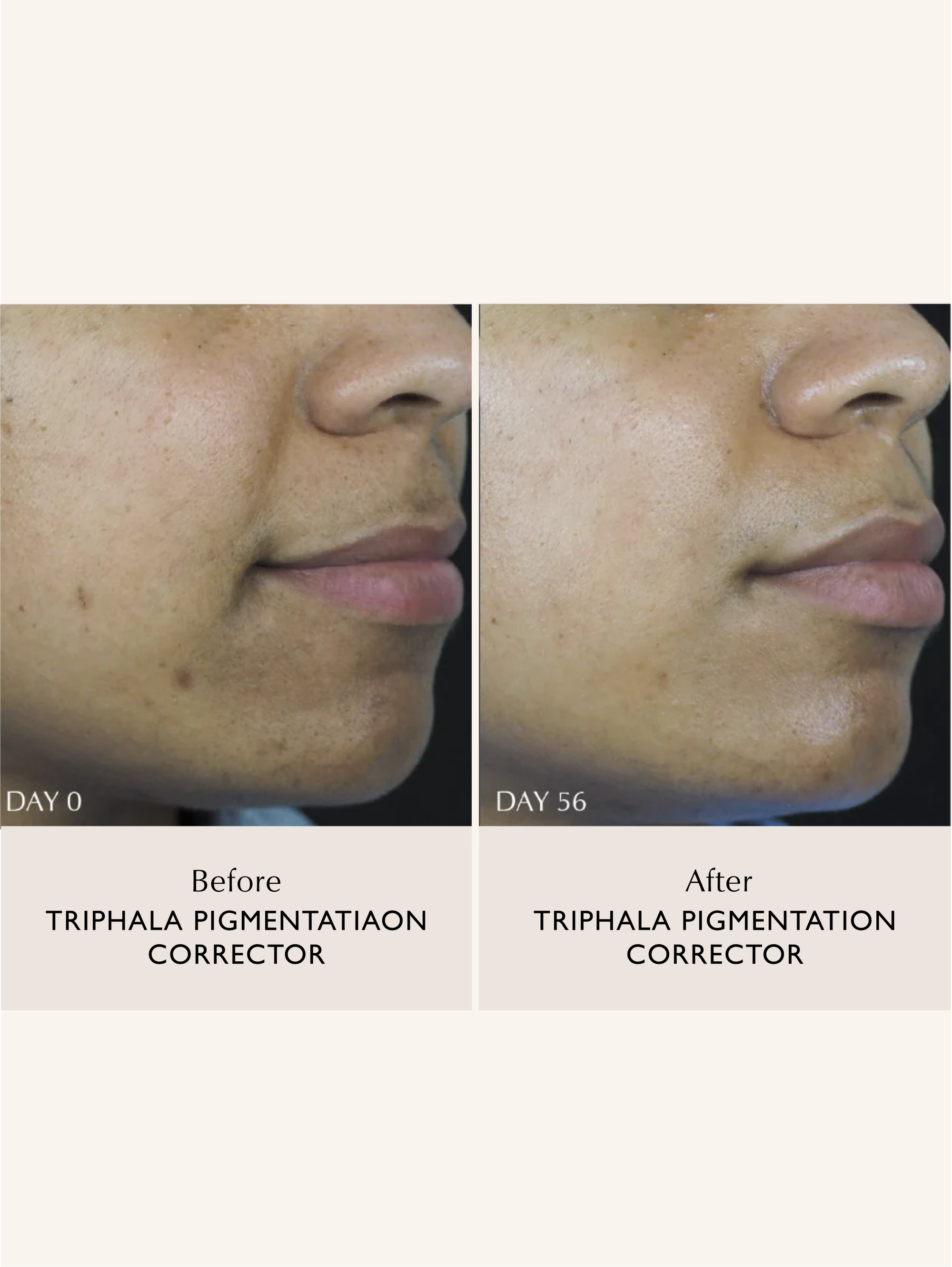 Sachi Skin - Triphala Pigmentation Corrector