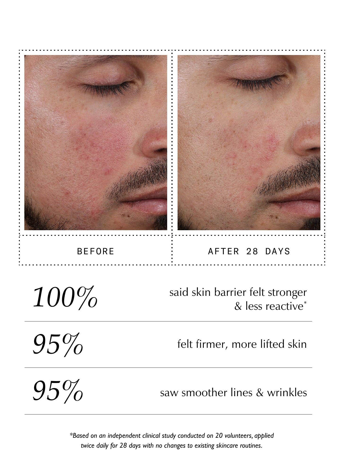 Sachi Skin - Peptide Pro Resilience® Serum Concentrate