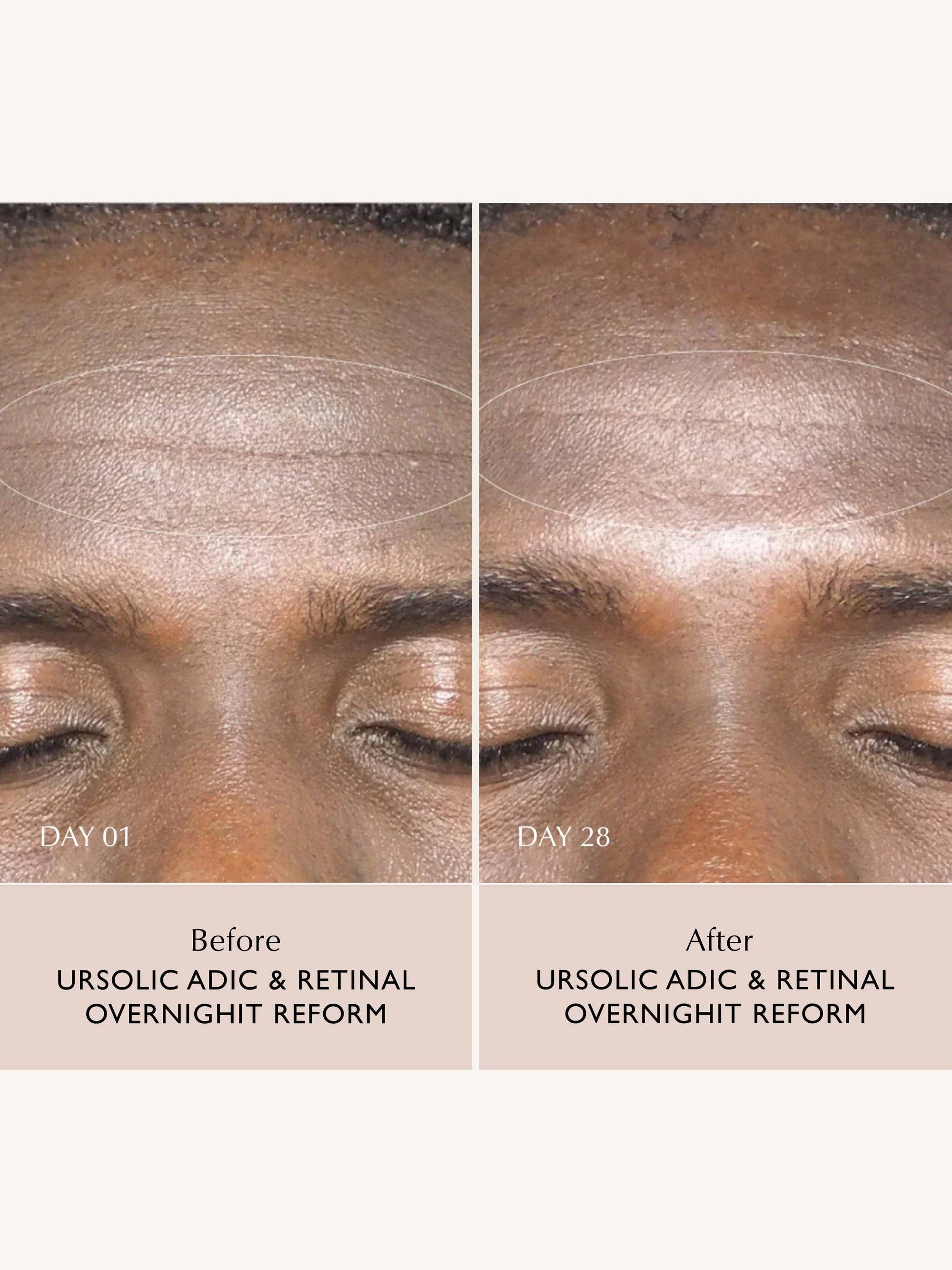 Sachi Skin - Ursolic Acid & Retinal Overnight Reform
