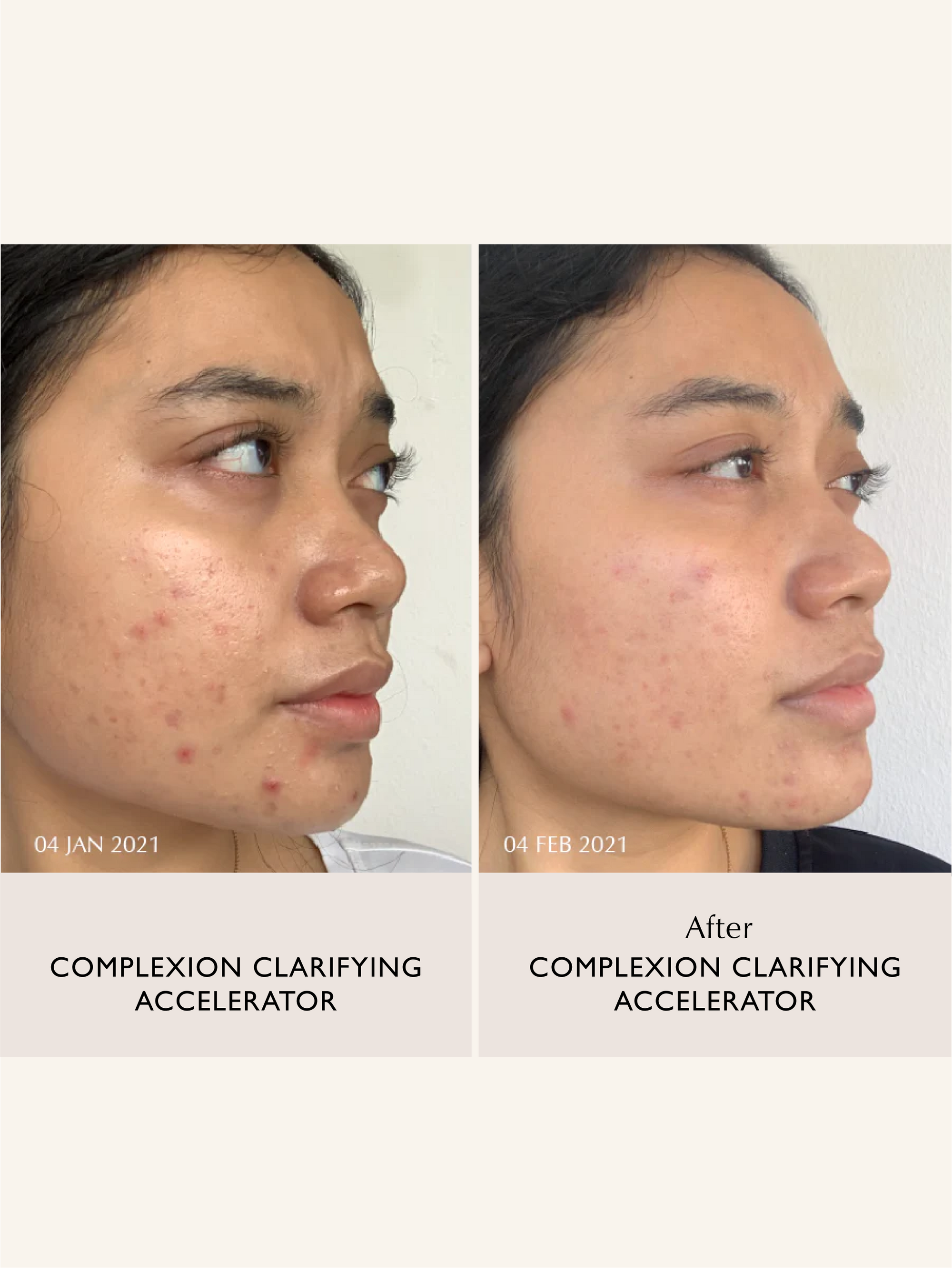 Sachi Skin - Complexion Clarifying Accelerator